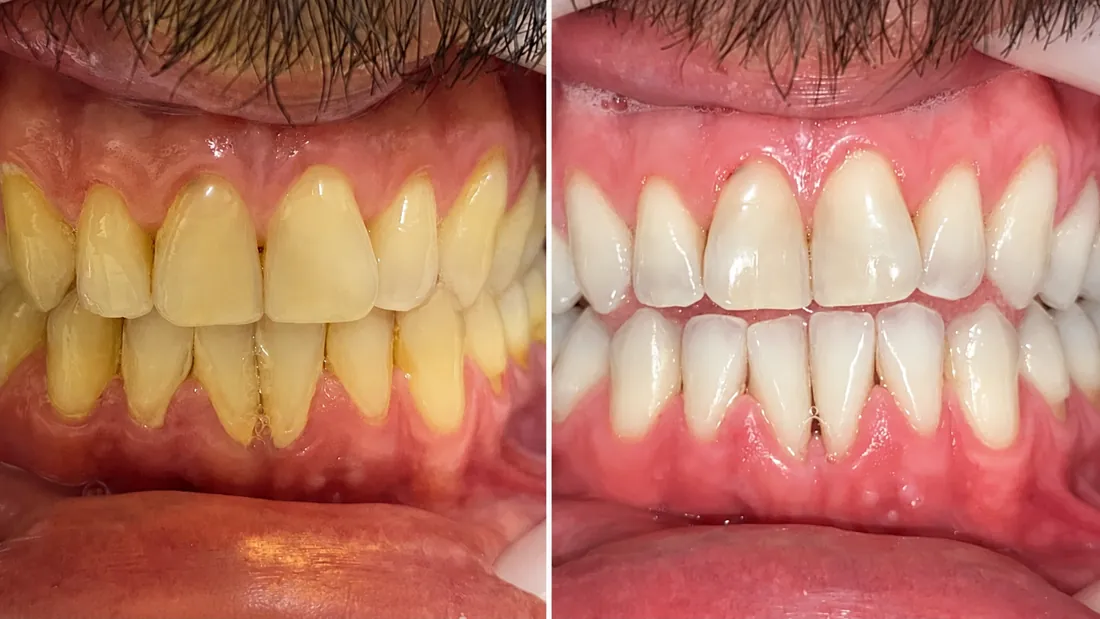 Sorriso renovado